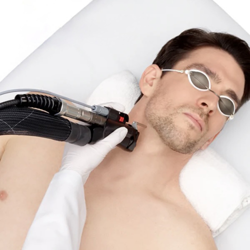 Man getting laser hair removal