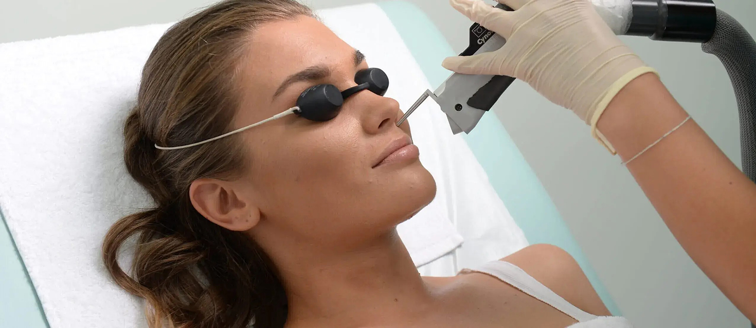 woman getting facial laser hair removal