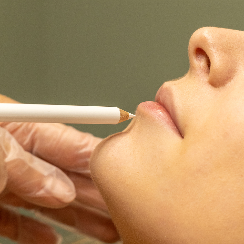 PCOS laser treatment